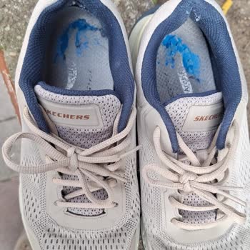 Aldığım Skechers Ayakkabının Kısa Sürede Bozulması Ve Garanti Sorunu