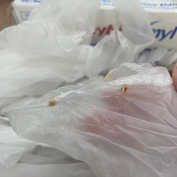 Temiz Diye Aldığım Eldivenden Şüpheli Parçalar Çıktı!