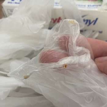 Temiz Diye Aldığım Eldivenden Şüpheli Parçalar Çıktı!