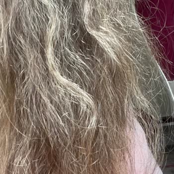 Saç Renklendirme İşlemi Sonrası Sağlık Sorunları Ve İstenmeyen Sonuçlar