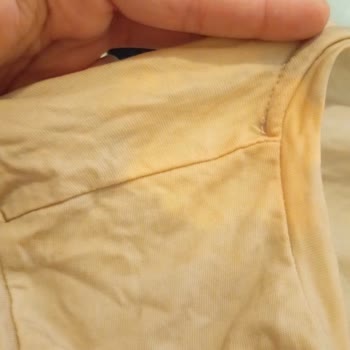 Kale Seyahat'te Bavulun Zarar Görmesi Ve Yetersiz Çözüm