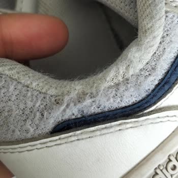 Adidas Ayakkabının Kısa Sürede Deforme Olması Ve Mağaza İncelemesinin Yetersizliği!