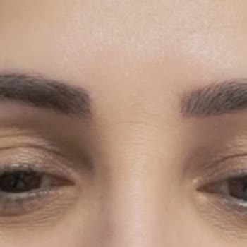 Kirpik Lifting İşleminde Farklı Sonuçlar Ve İlgisiz Yaklaşım