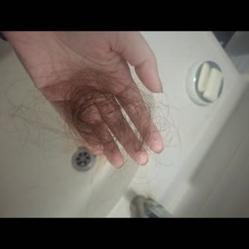 Aldığım Saçta Yoğun Dökülme Ve Kabarma Sorunu Yaşıyorum