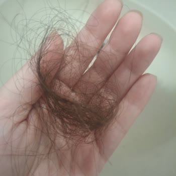 Aldığım Saçta Yoğun Dökülme Ve Kabarma Sorunu Yaşıyorum