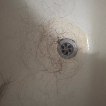 Aldığım Saçta Yoğun Dökülme Ve Kabarma Sorunu Yaşıyorum