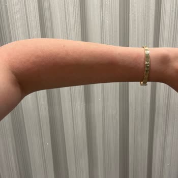 Dove Duş Köpüğü Kollarımda Alerjiye Sebep Oldu