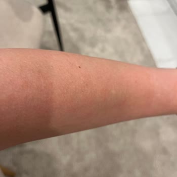 Dove Duş Köpüğü Kollarımda Alerjiye Sebep Oldu