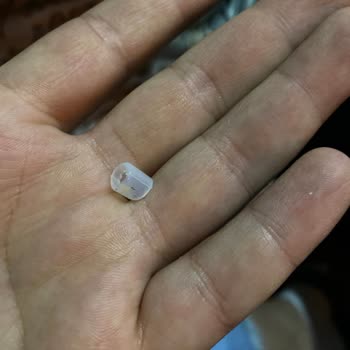 Üründe Bulunan Plastik Parça Çocuk Sağlığını Tehdit Etti