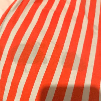 Electrolux Çamaşır Makinesinde Kalıcı Leke Sorunu Ve Çözüm Bulunamıyor