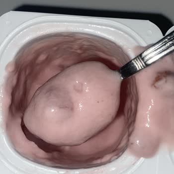 Son Kullanma Tarihi Geçmemiş Activia Yoğurt Bozuk Çıktı