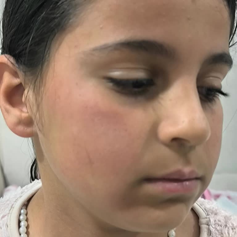 Duru Kaktüs Çiçeği Duş Jeli Yüzde Kızarıklık Ve Yanma Yaptı