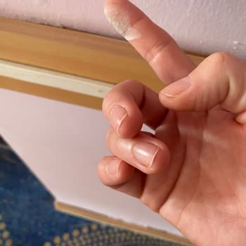 Side Win Hotel’de Temizlik Ve Yönetim Büyük Hayal Kırıklığı Yaşattı