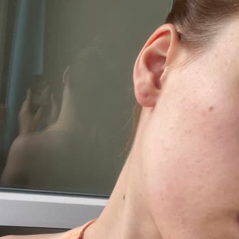 Cream Co. Tonik Ürünü Cildimde Alerjiye Neden Oldu!