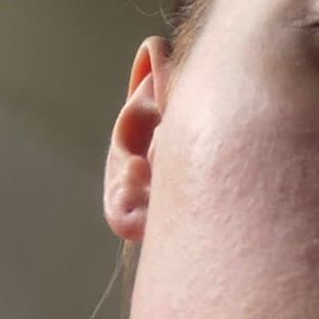 Cream Co. Tonik Ürünü Cildimde Alerjiye Neden Oldu!