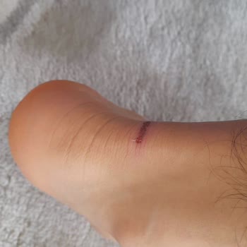 Spor Ayakkabı Ayağımı Yaraladı, Garanti Sorumluluğu Kabul Etmiyor