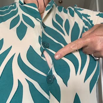 Yıkama Sonrası Çeken Elbise İçin İade Talebim Reddedildi