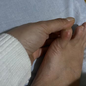 Kısa Sürede Ayağımı Rahatsız Eden Üründe İade Sorunu Ve Yetersiz Destek