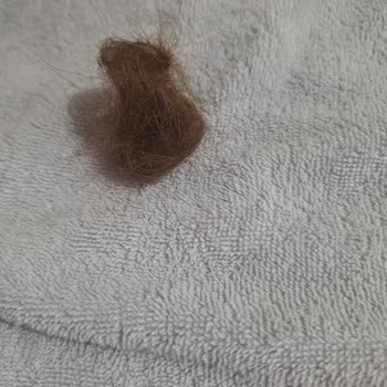 L'Oreal Excellence Creme Saç Boyası Sonrası Yoğun Saç Dökülmesi Yaşıyorum