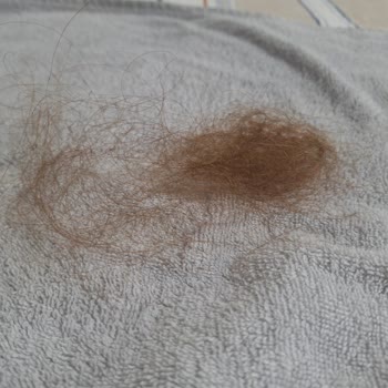 L'Oreal Excellence Creme Saç Boyası Sonrası Yoğun Saç Dökülmesi Yaşıyorum