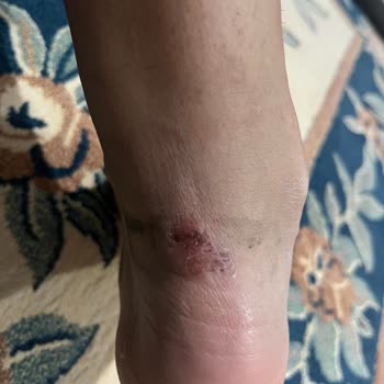 Asics Koşu Ayakkabısında Dar Kalıp Ve Çözülmeyen Sorun