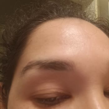 Kaş Ve Kirpik Serumundan Sonra Dökülme Sorunu Yaşadım