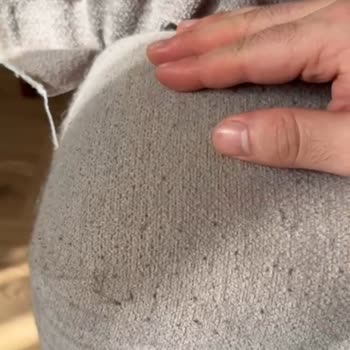 Magic Life Mobilya Koltuk Takımında Erken Deformasyon Ve Firma İlgisizliği Nedeniyle Mağduriyet!