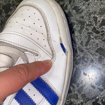 Adidas Forum Mid Ayakkabıda Kısa Sürede Açılma Ve Çözülmeyen İnceleme Süreci