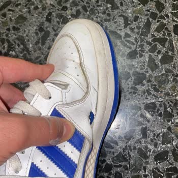 Adidas Forum Mid Ayakkabıda Kısa Sürede Açılma Ve Çözülmeyen İnceleme Süreci