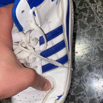 Adidas Forum Mid Ayakkabıda Kısa Sürede Açılma Ve Çözülmeyen İnceleme Süreci