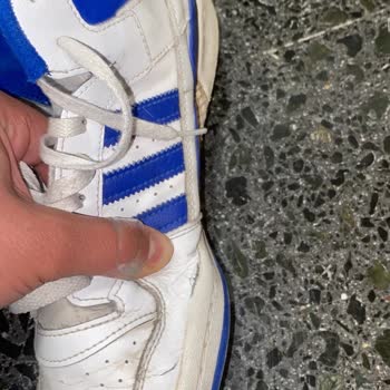 Adidas Forum Mid Ayakkabıda Kısa Sürede Açılma Ve Çözülmeyen İnceleme Süreci
