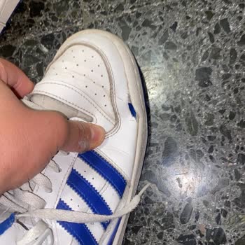 Adidas Forum Mid Ayakkabıda Üretim Hatası Ve Boyner'in İlgisizliği