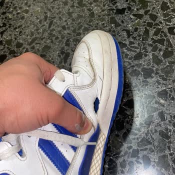 Adidas Forum Mid Ayakkabıda Üretim Hatası Ve Boyner'in İlgisizliği