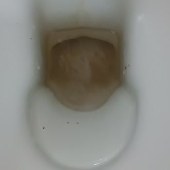 Klozet Temizliği Sürekli Sorun Oluyor, Çözüm Bekliyorum