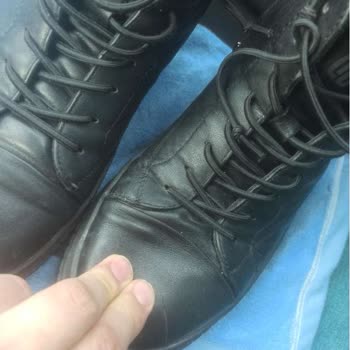 Kusurlu Ürün İçin Değişim Ve Fiyat Farkı Sorunu Yaşadım