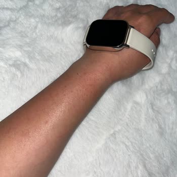 Xiaomi Watch 5 Lite Kordonu Alerji Yaptı, İade Veya Değişim Talebi