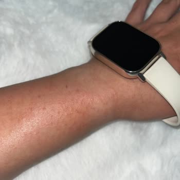 Xiaomi Watch 5 Lite Kordonu Alerji Yaptı, İade Veya Değişim Talebi