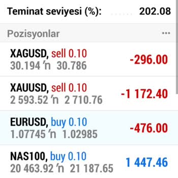 Forex Yüzünden Tüm Birikimimi Ve Sağlığımı Kaybettim