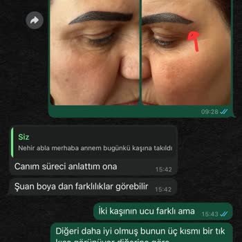 Kaş Tasarımında Memnuniyetsizlik Ve Ek Ücret Talebi