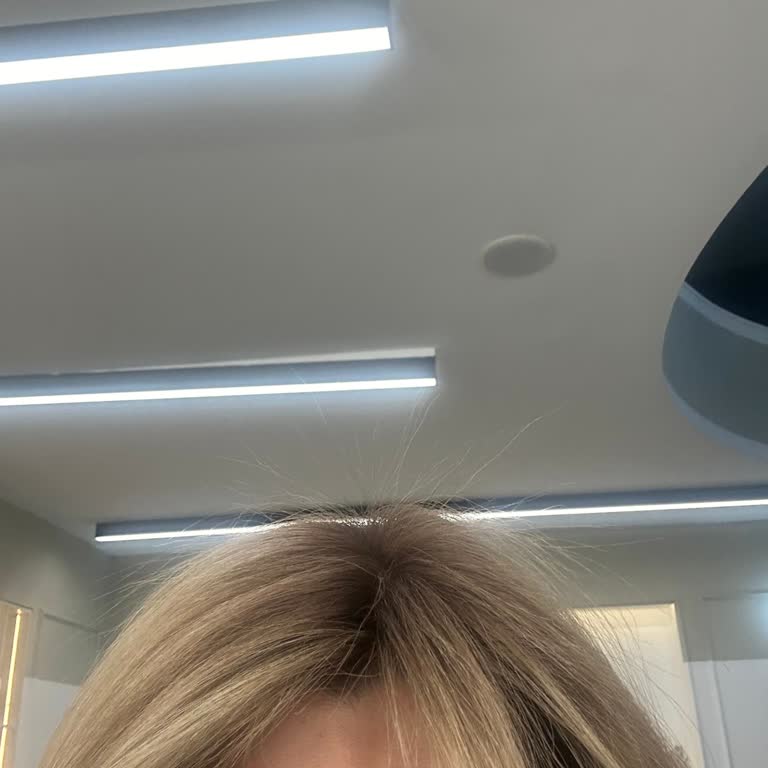 Kuaförde Saçım Yandı, Uzun Süredir Toparlanmadı