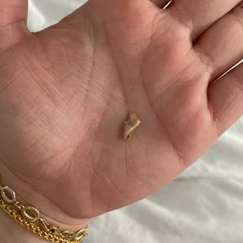 Lezita Nugget İçinden Sert Ve Tanımlanamayan Madde Çıktı