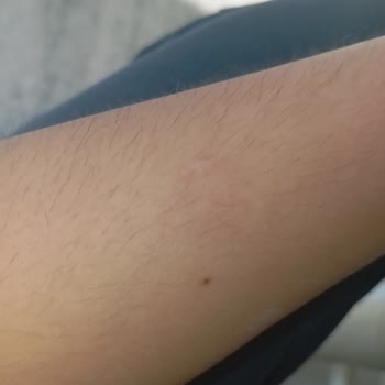 Watsons Kuru Şampuan Derimde Alerji ve Saçımda Zarar Yarattı