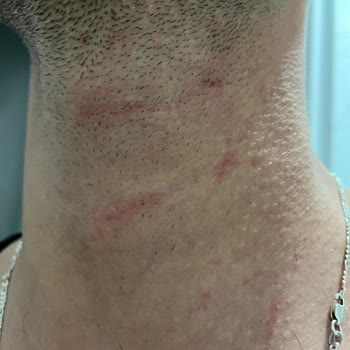 Philips Tıraş Makinesiyle Sürekli Kesik Yaşadım Servisten Çözüm Alamadım