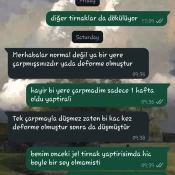 Protez Tırnaklar Kısa Sürede Bozuldu, Kaba Tavır Ve Ek Ücret Talebiyle Karşılaştım