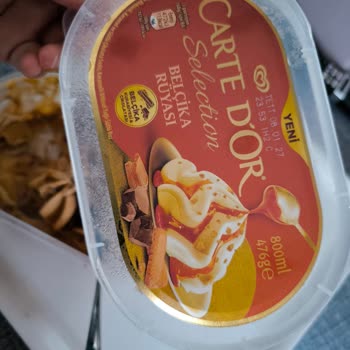 Algida Dondurma Paketinden Saç Çıkması Şok Etti