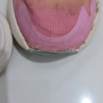 Hummel Refused to Replace the Shoes That Fell Apart After Light Use