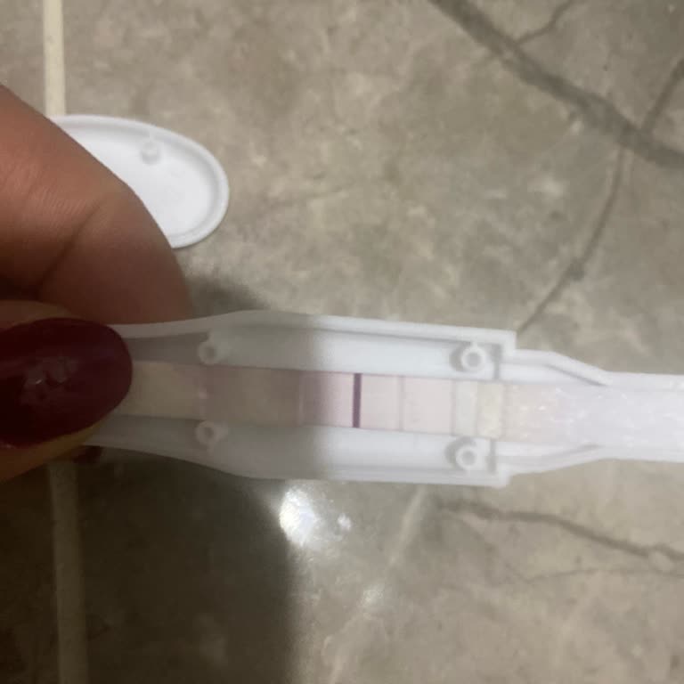 Prodoctor Test Sonucu Hatalı!