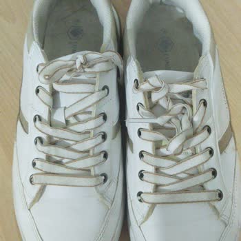 Orijinal Diye Aldığım Ayakkabı Sahte Çıktı Ayağımı Yaraladı Çözüm Yok