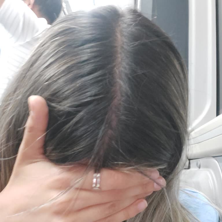 Saç Boyası Sonrası Yanan Saçlar Ve İstenmeyen Sonuç