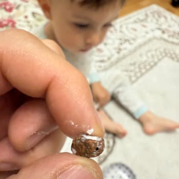 Lokum İçinden Taş Çıkması Ve Çocuğumun Sağlığı Tehlikeye Girdi